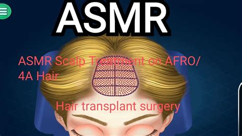 Asmr Scalp Treatment On Afro 4a Hair Hair Transplant Surgeryasmr
