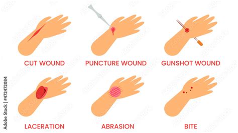 Abstract Flat Doctor Help Types Of Injuries Cut Puncture Gunshot