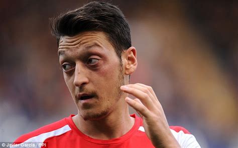 Mesut Ozil Out Until 2015 With Knee Ligament Damage In Blow To Arsenal