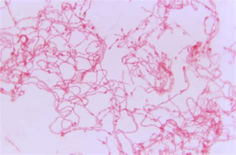 Streptobacillus Moniliformis — Superbugs The Microbial World In On