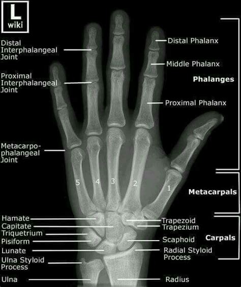 8 Best Hand Bones Anatomy Images On Pinterest Hand Bone Anatomy