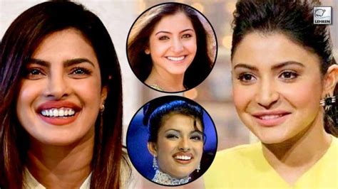 Priyanka Chopra To Anushka Sharma Actresses Who Had Plastic Surgery