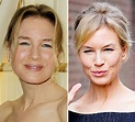 Renée Zellweger Turns 51: How Plastic Surgery Changed Her Look Over the ...