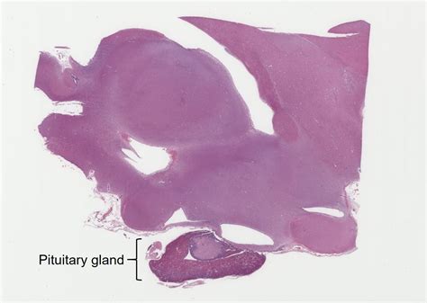 Pituitary Gland Veterinary Histology