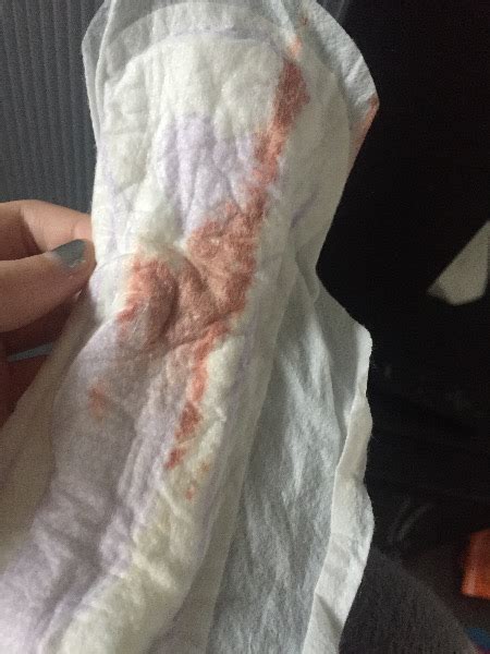 How Does Implantation Bleeding Look Like On A Pad Diy