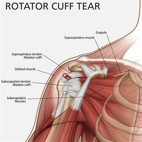 The Anatomy Of The Shoulder And Arm Showing Rotator Cuff Tears Scapula
