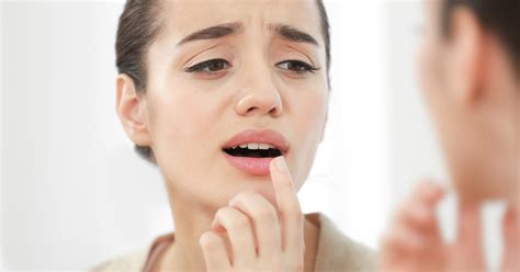 What Having Lupus Mouth Sores Feels Like And How They Can Be Treated 2022