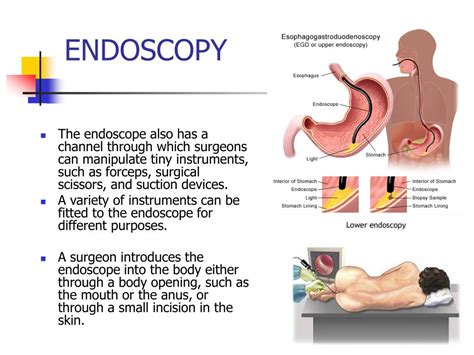 Ppt Endoscopy Powerpoint Presentation Free Download Id527805