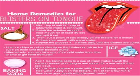 Pin By Kathy Amburgey On Tongue Blister Remedies Blister On Tongue