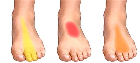 Foot Pain Causes And Symptoms