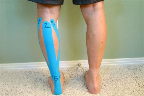 Kinesiological Taping For Osgood Schlatter Disease The Physical