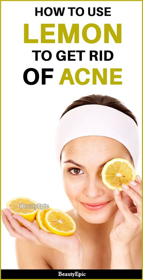 How Do You Get Rid Of Acne With Lemon Juice How To Get Rid Of Acne