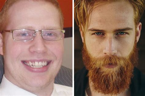 155 Awesome Before And After Photos Of Men Who Underwent Full On