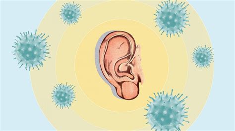 Everything You Need To Know About Tinnitus Causes Symptoms