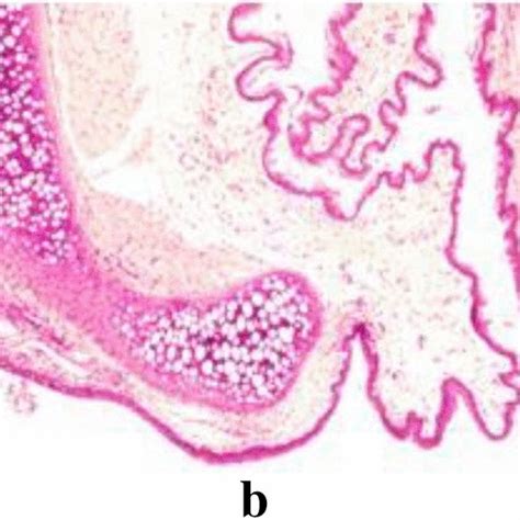 Histopathological Changes In Larynx A Inflammation In Laryngeal
