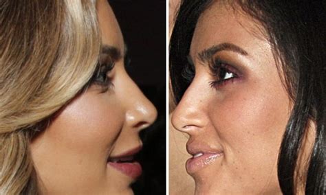 Kim Kardashian And The Riddle Of The Nose How Reality Stars Profile