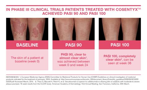 New Cosentyx® Treatment Can Clear Skin Of Patients With Psoriasis