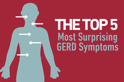 Top 5 Most Surprising Gerd Symptoms Temple Health