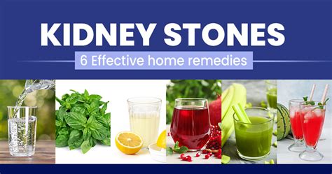 Home Remedies And Natural Treatment For Kidney Stone Star Health