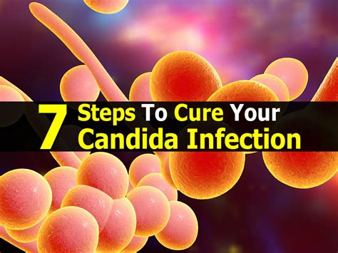 Steps To Cure Your Candida Infection