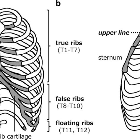 Anatomical And Biomechanical Features Of The Rib Cage A The T17 Ribs