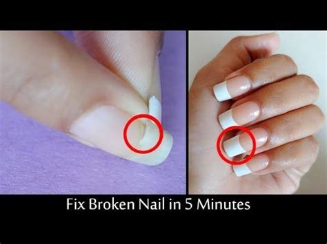You might spend 10 hours talking on a telephone conversation. FIX BROKEN NAIL- IN 5 MINUTE - YouTube | Fix broken nail ...