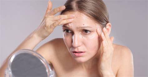 11 Signs Of Health Problems Written Right On Your Face Londonhealth