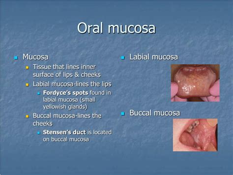 Ppt Landmarks Of The Face And Oral Cavity Powerpoint Presentation