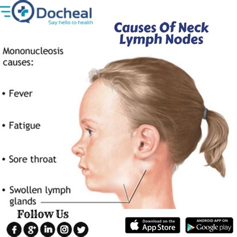 Can A Common Cold Cause Neck Lymph Nodes Quora