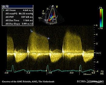 Case 163 - Echopedia