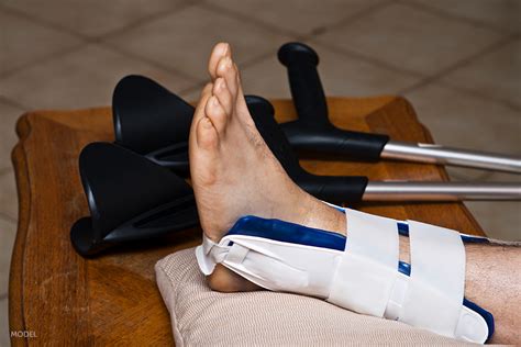 Tips To Recover Faster From A Stress Fracture Dr Verville