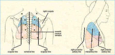 Auscultating Heart And Lung Sounds Nursing Students Nursing School