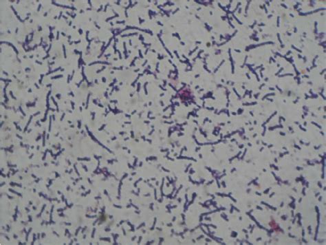 Gram Positive Cocci Streptococcus