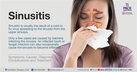 sinusitis types causes symptoms complications and treatment