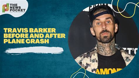 Travis Barker Before And After Plane Crash Everything You Need To Know