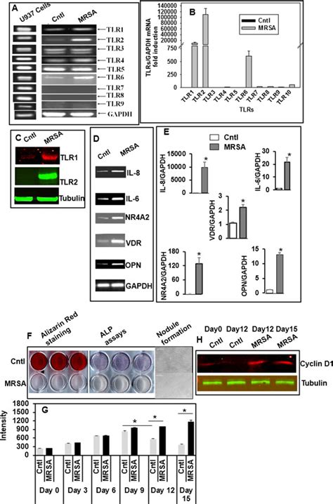 Mrsa Co Culture Induces Tlrs Expression By Hmscs Human Mscs Total Rna Download Scientific