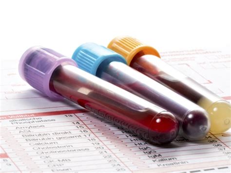 O melhor e mais flexível sistema de gestão para clínicas de radiologia do brasil. Instituto Oncofisio - Papel dos exames laboratoriais no ...