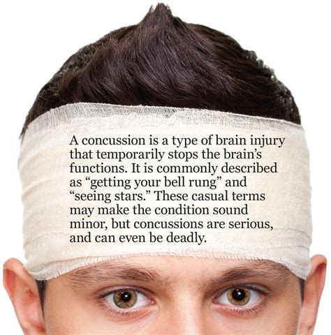 But new research is saying that even a single concussion may cause lasting how do you know if you have a concussion? Pursuing concussion's cure | Mission magazine | UT Health ...