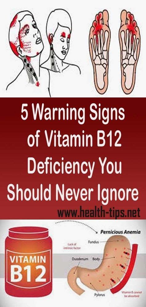 Warning Signs Of Vitamin B Deficiency You Should Never Ignore With
