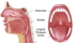 Tonsillectomy And Adenoidectomy T A Fort Worth Ent Sinus