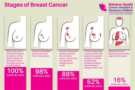 Symptoms And Complications To Understanding Breast Cancer