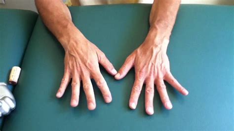 Self Massage For Thumb Arthritis Thumb Arthritis Yoga For Arthritis Arthritis