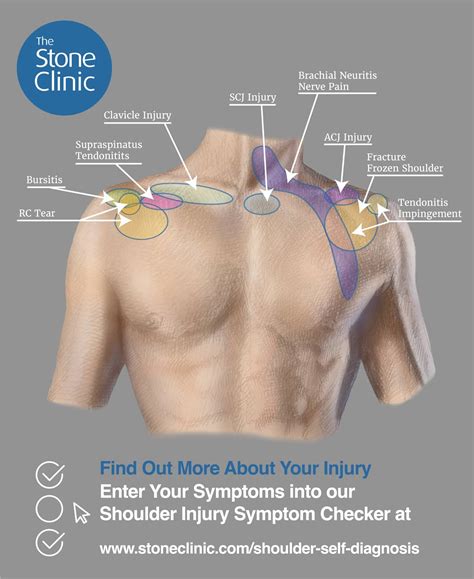 Shoulder Pain Symptom Checker And Pain Diagnosis Chart Injury Self