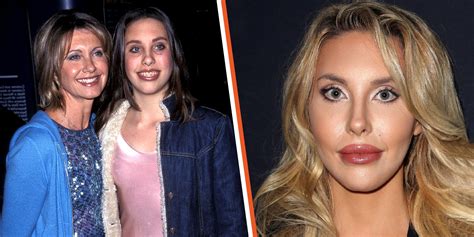 Chloe Lattanzi Admitted To Having Had Plastic Surgery Inside Her Body And Face Transformation