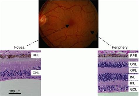 Electrical Signals Of The Retina And Visual Cortex Ento Key