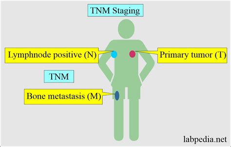 Tumor Marker Part Definition Of Tumor Markers Staging And Grading Labpedia Net