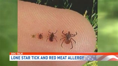 Doc Talk Lone Star Tick And Red Meat Allergy Whp