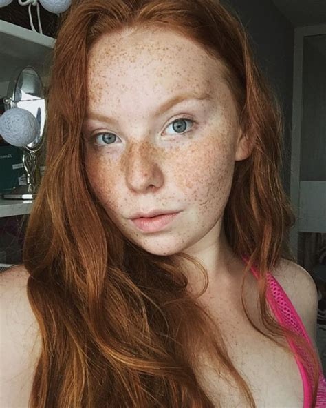 Women With Freckles Beautiful Freckles Redheads Red Hair Beautiful