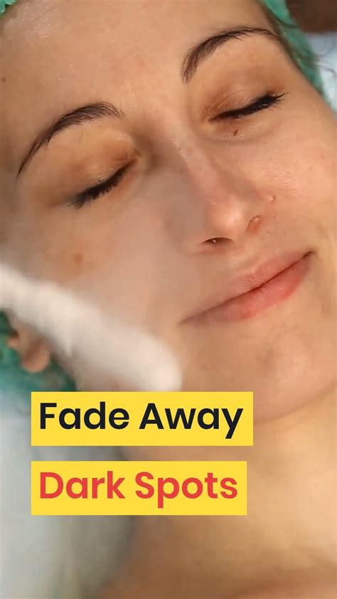 How To Fade Dark Spots Naturally How To Fade Dark Spots On Face