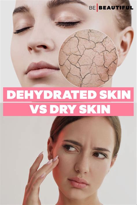 Dehydrated Skin Vs Dry Skin Causes Symptoms And Treatment Facial